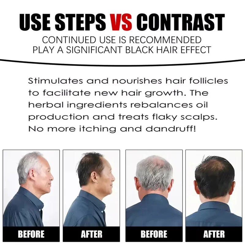 Herbal Anti-grey Treatment Hair Dye Shampoo White To Black Permanent Repair Natural Color Nourish Scalp Hair Care Products