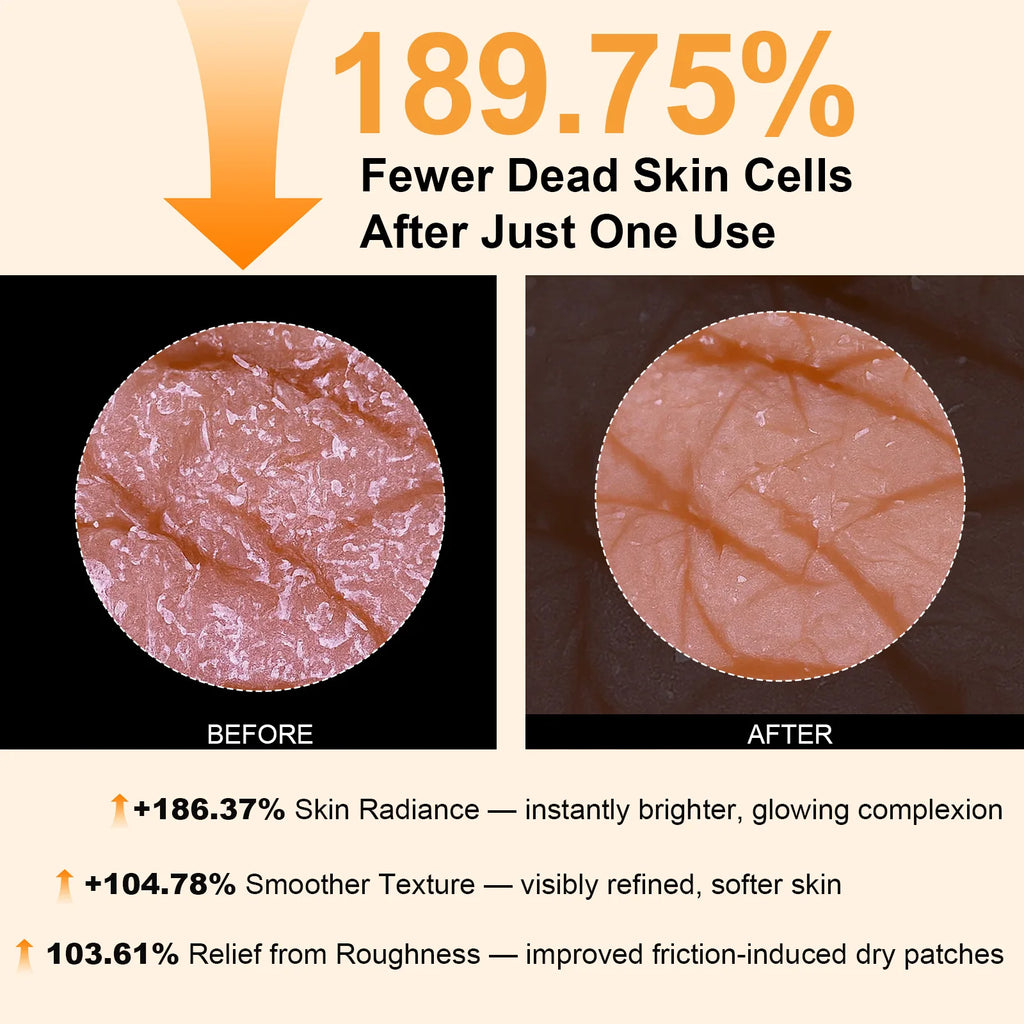 Kojic Acid Turmeric Exfoliating Body Spray – Brightening Peeling Solution 100ml
