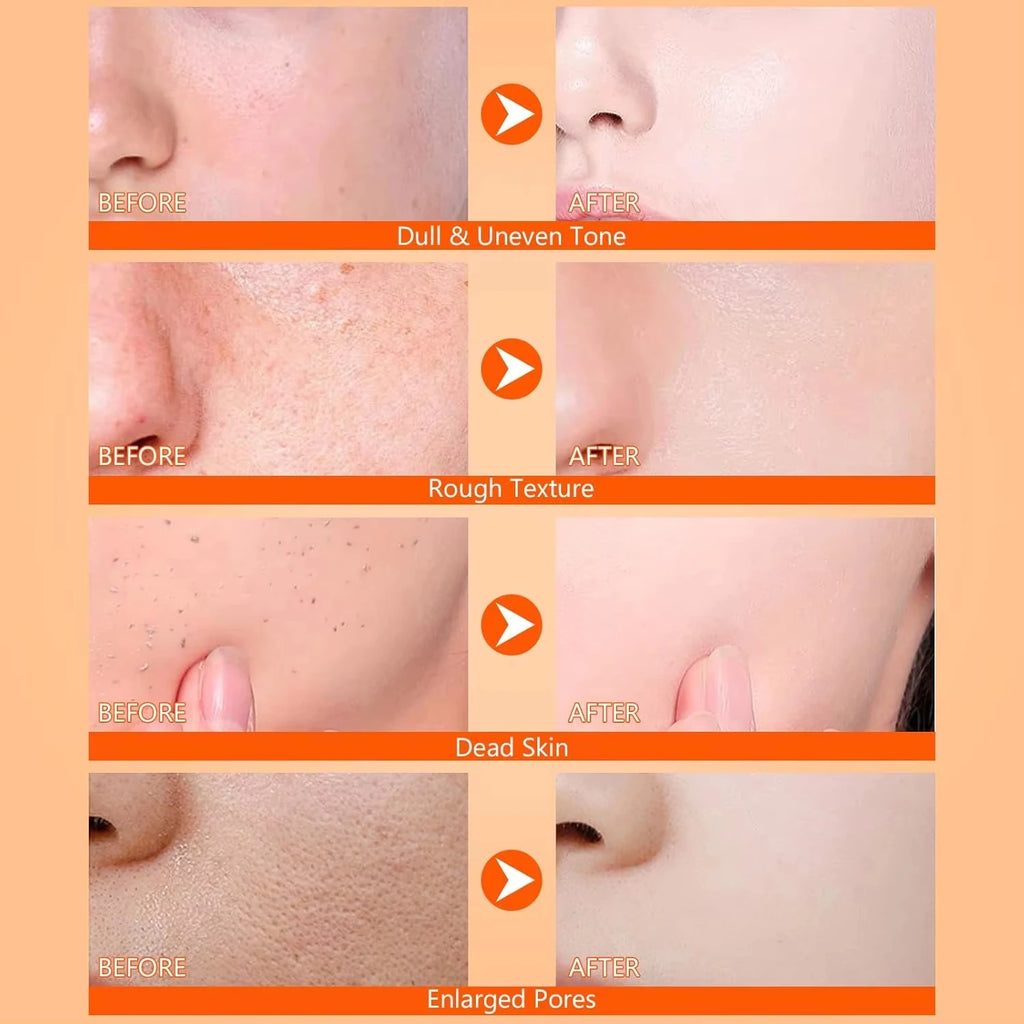 Kojic Acid Turmeric Exfoliating Body Spray – Brightening Peeling Solution 100ml