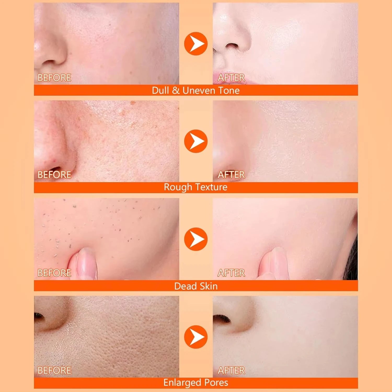 Kojic Acid Turmeric Exfoliating Body Spray – Brightening Peeling Solution 100ml