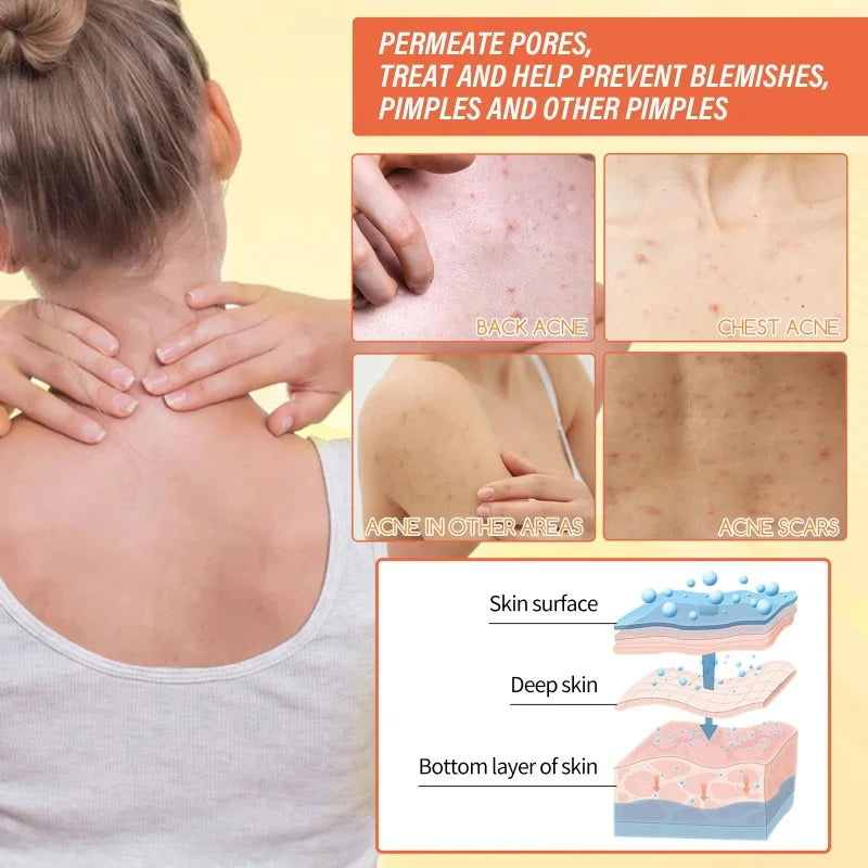 Body Whitening & Brightening Soap Bar – Bleaching Scrub for Knees, Armpits & Intimate Areas