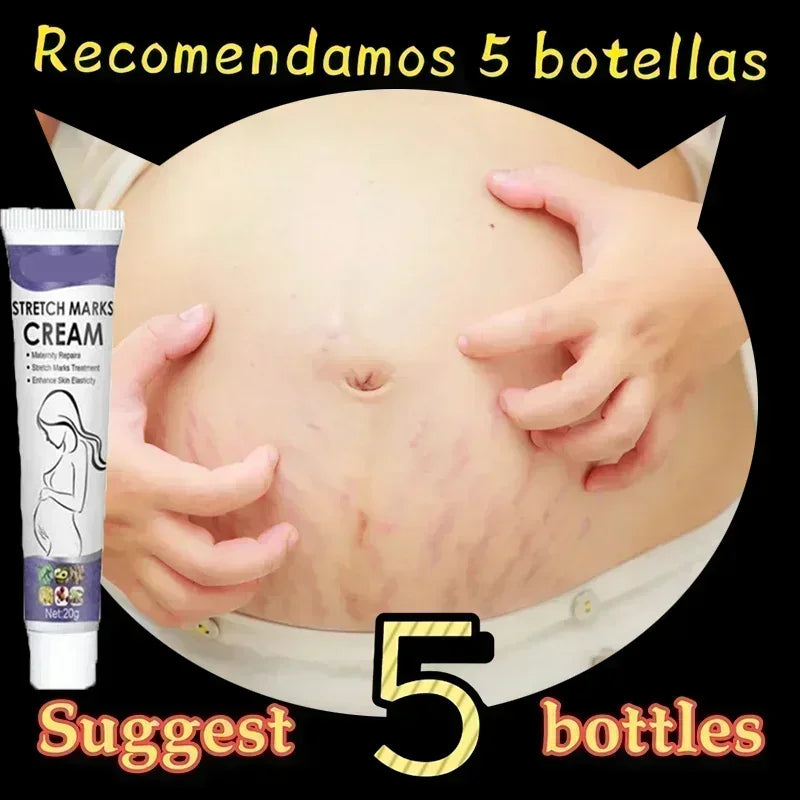 Stretch Marks Treatment & Repair Body Oil — Anti-Wrinkle Skin Care Oil for Maternity & Postpartum