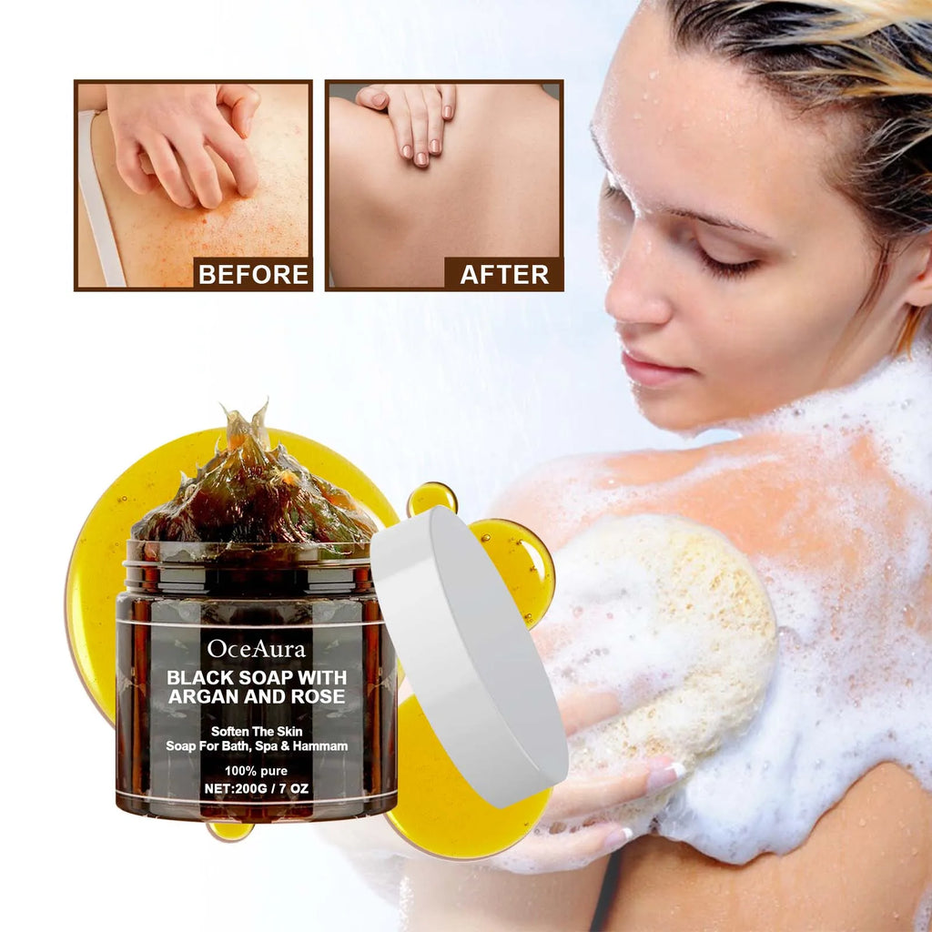 OceAura Black Soap with Argan & Rose – Beldi Dead Skin Remover, Body Scrub & Deep Cleansing, 200g