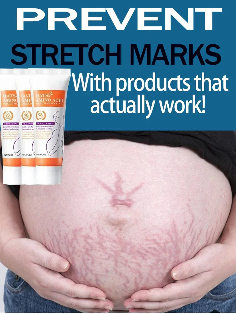 Stretch Marks Permanent Removal Cream — Repair, Firming & Skin Elasticity Body Cream 40g