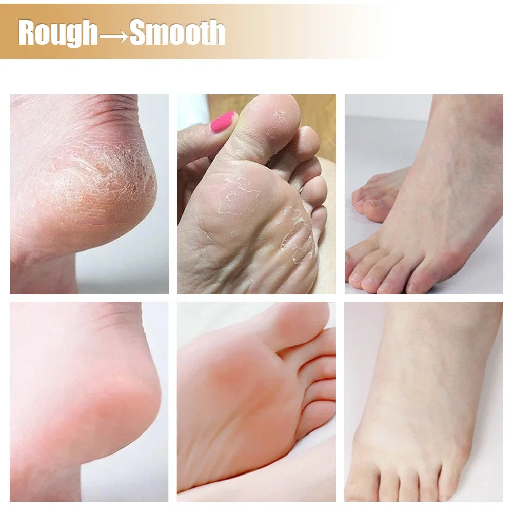 Silicone Moisturizing Hand & Foot Mask Socks – Reusable Exfoliating Gloves