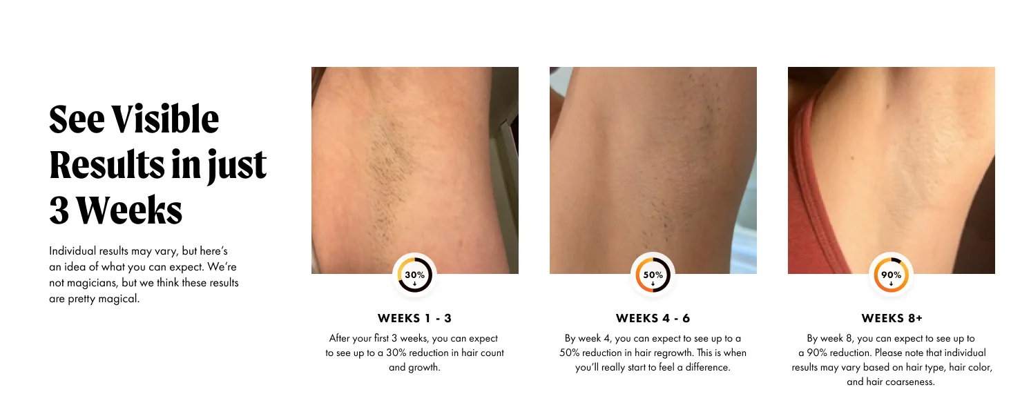IPL Laser Hair Removal Device with Ice Cooling