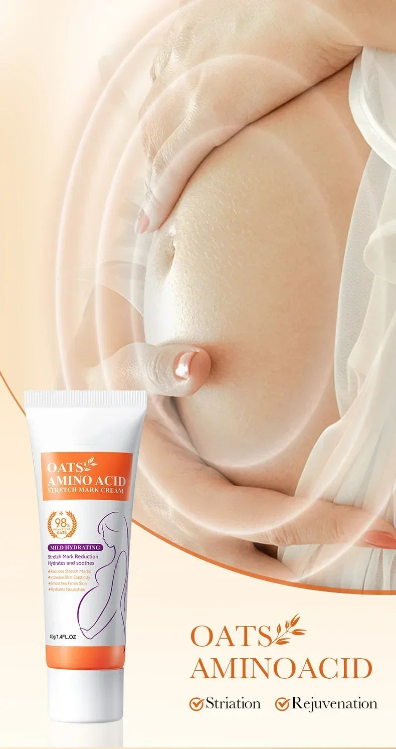 Stretch Marks Permanent Removal Cream — Repair, Firming & Skin Elasticity Body Cream 40g
