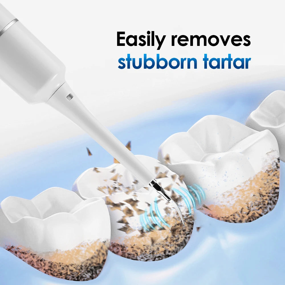 Dentist-Level Clean at Home — Electric Teeth Cleaner & Tartar Remover | 6-Gear Modes, 31,000 Vibrations/Min, IPX6 Waterproof, Type-C Charging