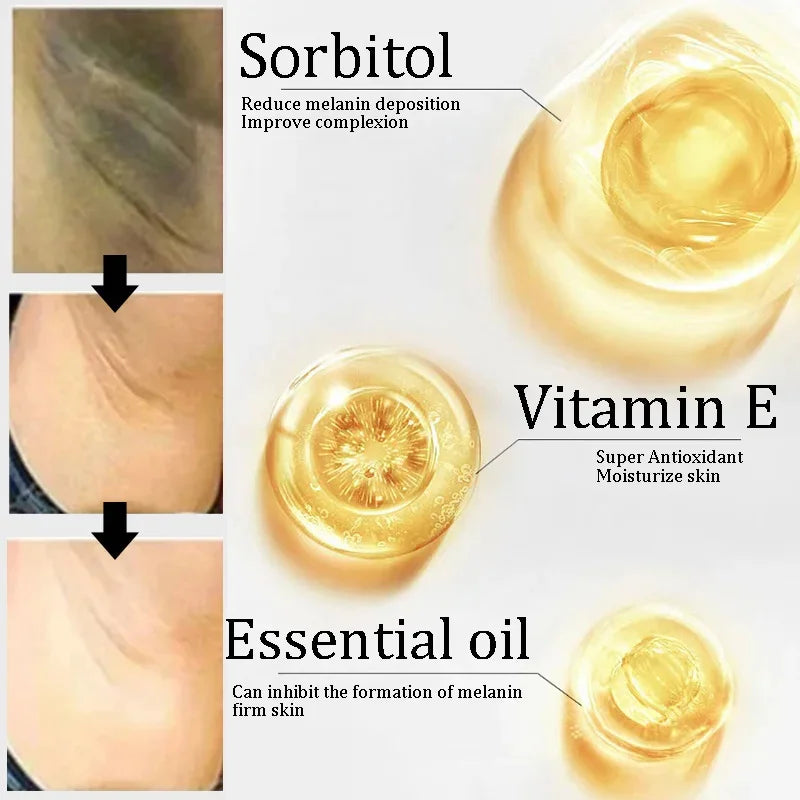 Body Whitening & Brightening Soap Bar – Bleaching Scrub for Knees, Armpits & Intimate Areas