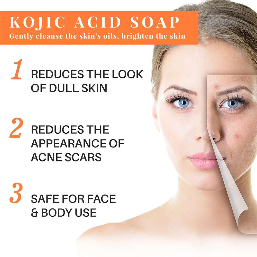 Kojic Acid Brightening Soap Bar – Handmade Natural Cleansing Bath Bar for Dark Spots & Even Skin Tone