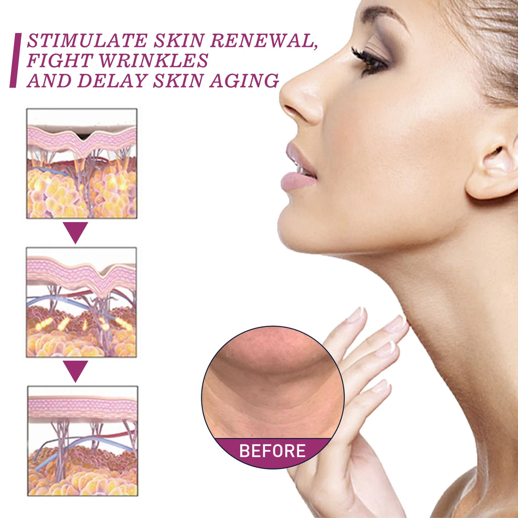 Collagen Neck Cream — Firming, Lifting & Double Chin Reducer