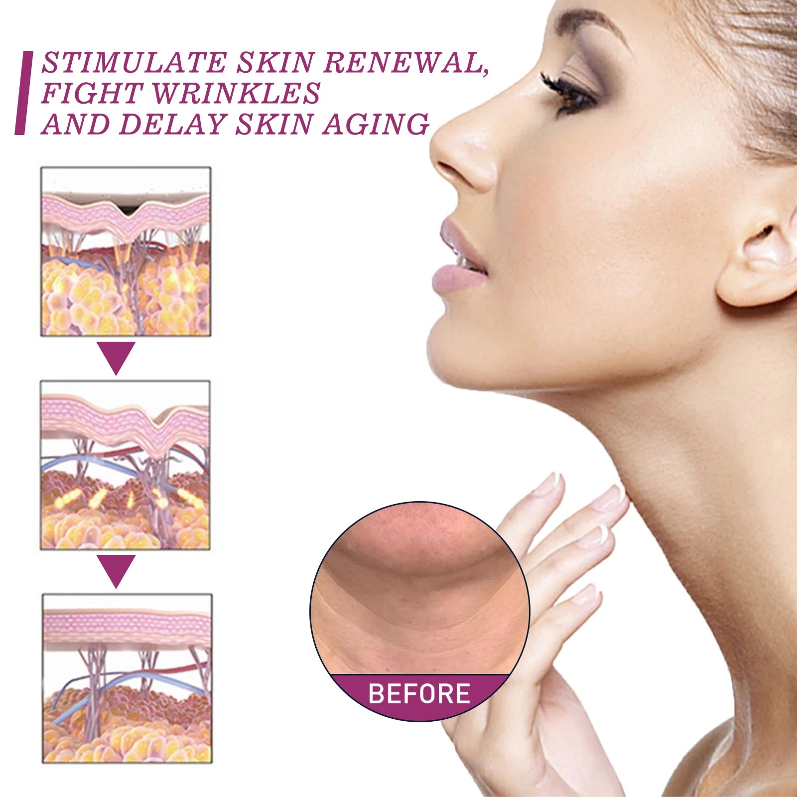 Collagen Neck Cream — Firming, Lifting & Double Chin Reducer