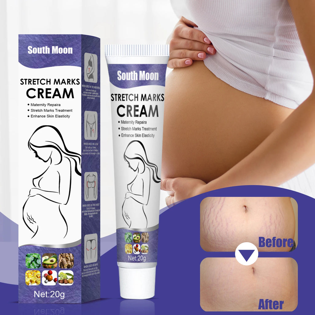 Stretch Marks Permanent Removal Cream — Maternity Repair, Anti-Wrinkle & Firming Skin Care 20g