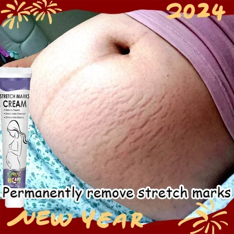 Stretch Marks Treatment & Repair Body Oil — Anti-Wrinkle Skin Care Oil for Maternity & Postpartum