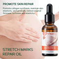 Stretch Marks Remover Essential Oil — Pregnancy & Maternity Stretch Mark Removal Serum, Skin Elasticity
