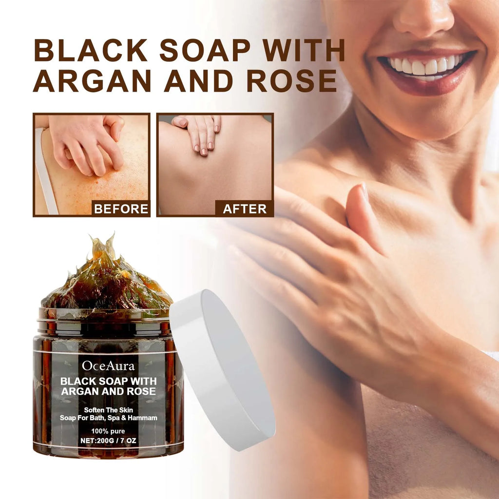 OceAura Black Soap with Argan & Rose – Beldi Dead Skin Remover, Body Scrub & Deep Cleansing, 200g