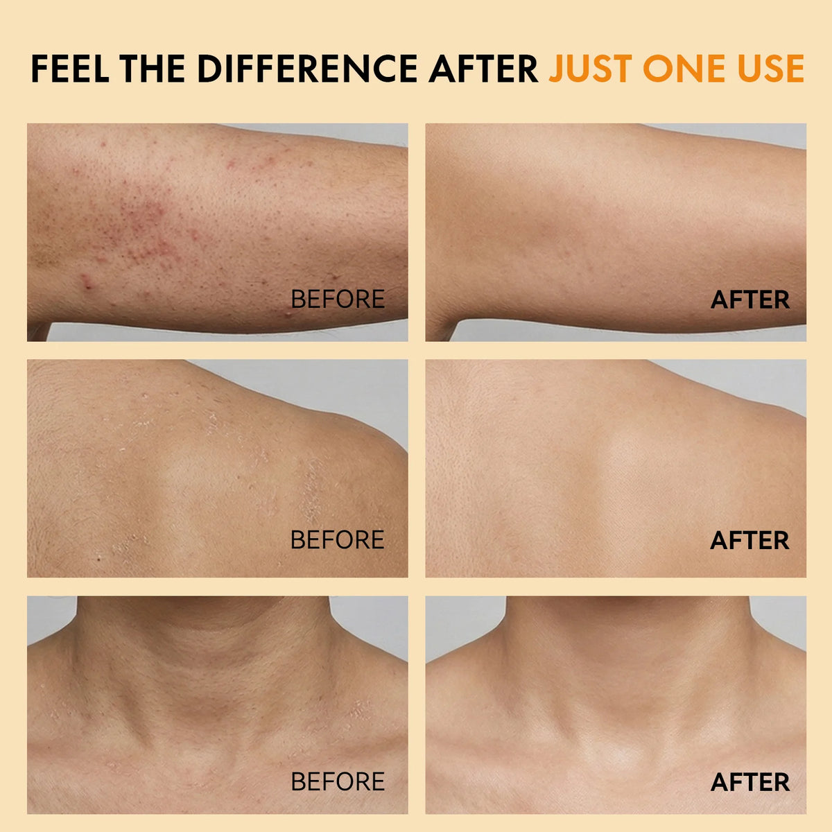 Kojic Acid Turmeric Exfoliating Body Spray – Brightening Peeling Solution 100ml