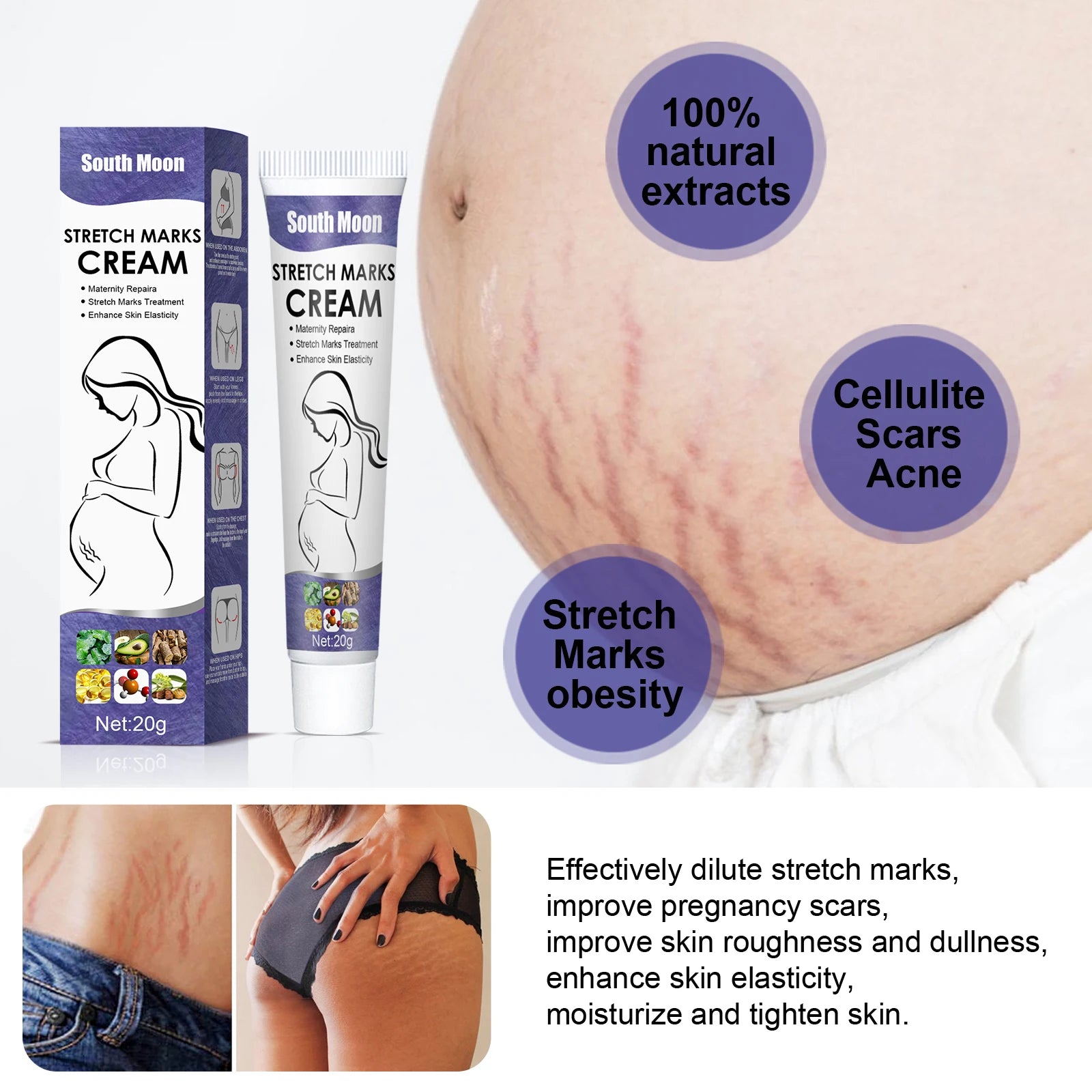 Stretch Marks Permanent Removal Cream — Maternity Repair, Anti-Wrinkle & Firming Skin Care 20g