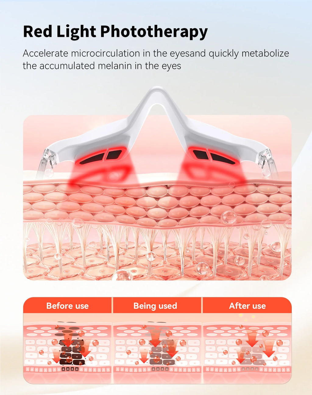 3D EMS Eye Massager with 620nm Red Light – Microcurrent Eye Care & Skin Beauty Device by SUYZEKO