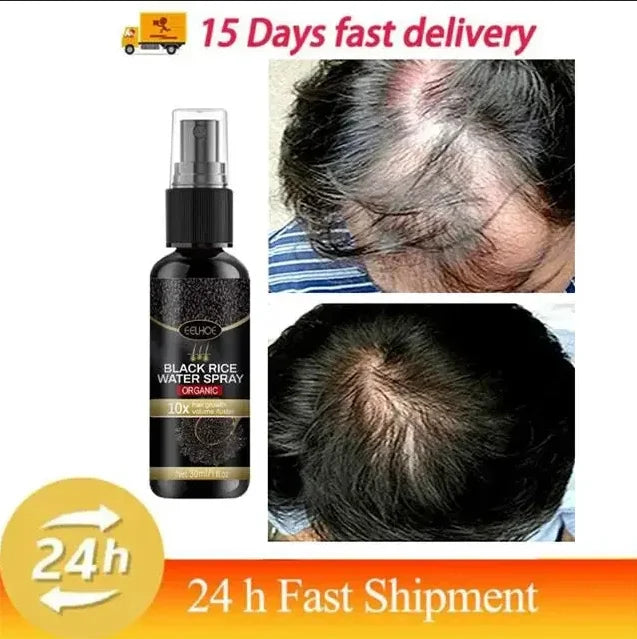Black Rice Fast Hair Growth Serum Spray for Men Women Anti-loss Hair Regrowth Essential Oil Scalp Treatment Hair Care Products