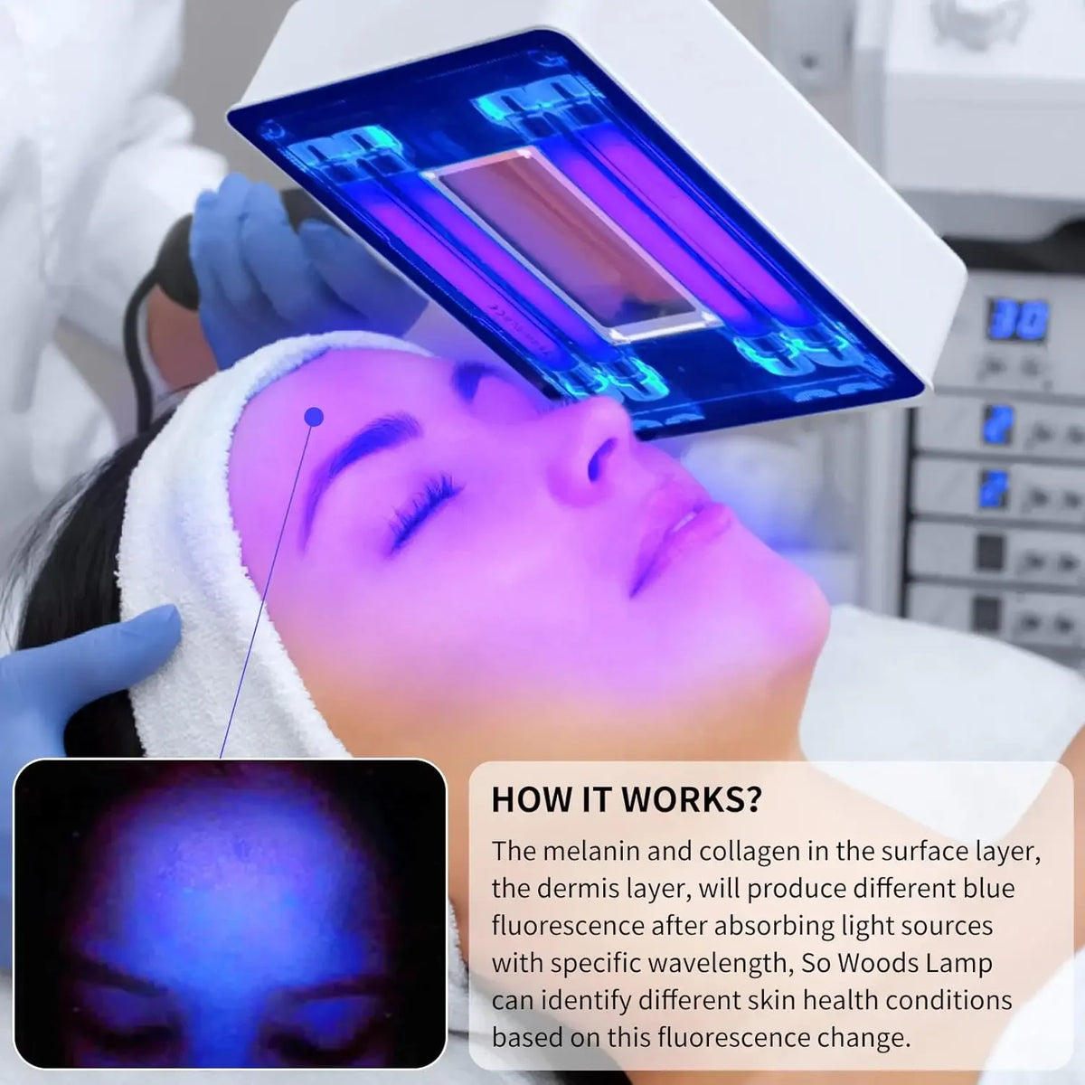 Wood's Lamp UV Skin Analyzer – 365nm UV Light Skin Scanner with 3x Magnifying Lens for Home & Salon Use