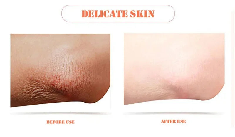 Body Whitening & Brightening Soap Bar – Bleaching Scrub for Knees, Armpits & Intimate Areas