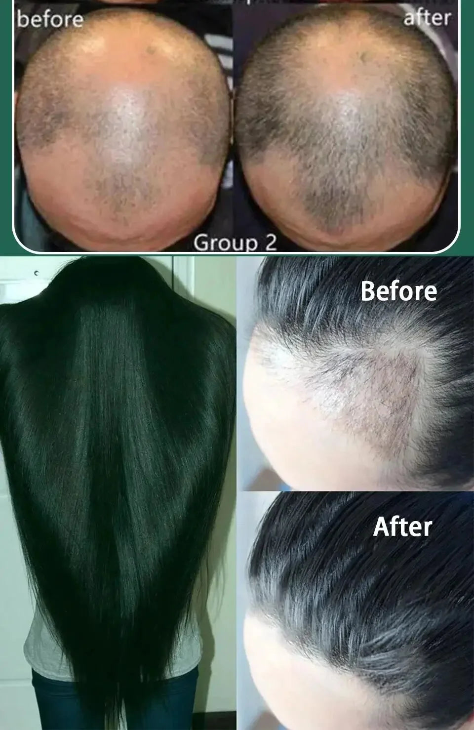 Batana Oil Hair Growth Serum Spray Repair Hair Nourish Root Regrowth Hair Anti Hair Loss Essence Men Women Hair Care Products