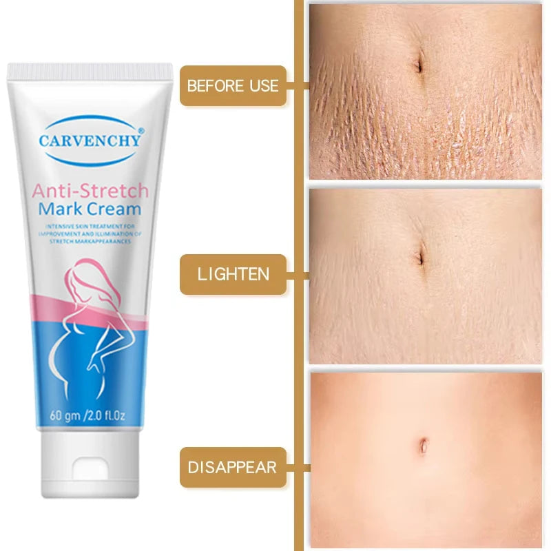 Snail Removes Stretch Mark Cream — Postpartum Firming, Anti-Aging & Wrinkle Repair Body Cream 60g