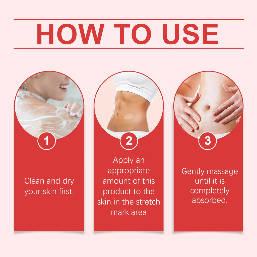 OUHOE Stretch Mark Removal Cream — Postpartum Firming, Anti-Fine Lines & Maternity Body Lotion 80g