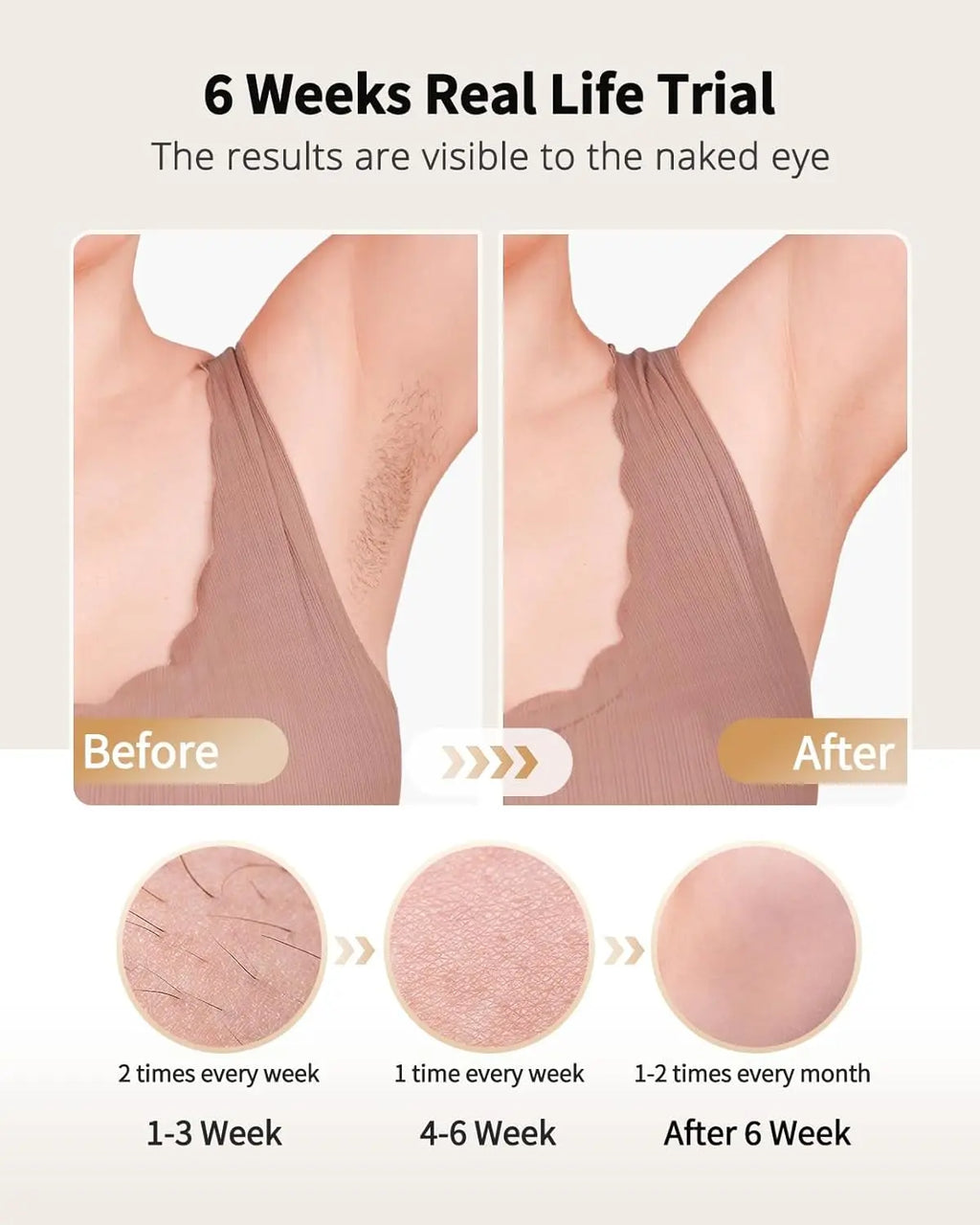IPL Laser Hair Removal Device with Ice Cooling