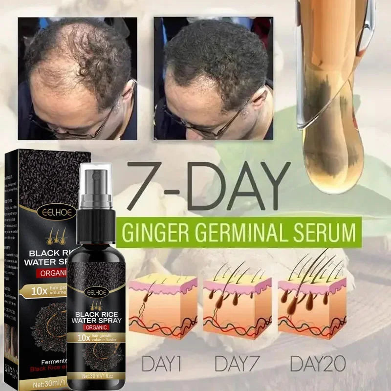 Black Rice Fast Hair Growth Serum Spray for Men Women Anti-loss Hair Regrowth Essential Oil Scalp Treatment Hair Care Products