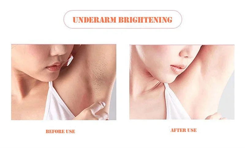 Body Whitening & Brightening Soap Bar – Bleaching Scrub for Knees, Armpits & Intimate Areas
