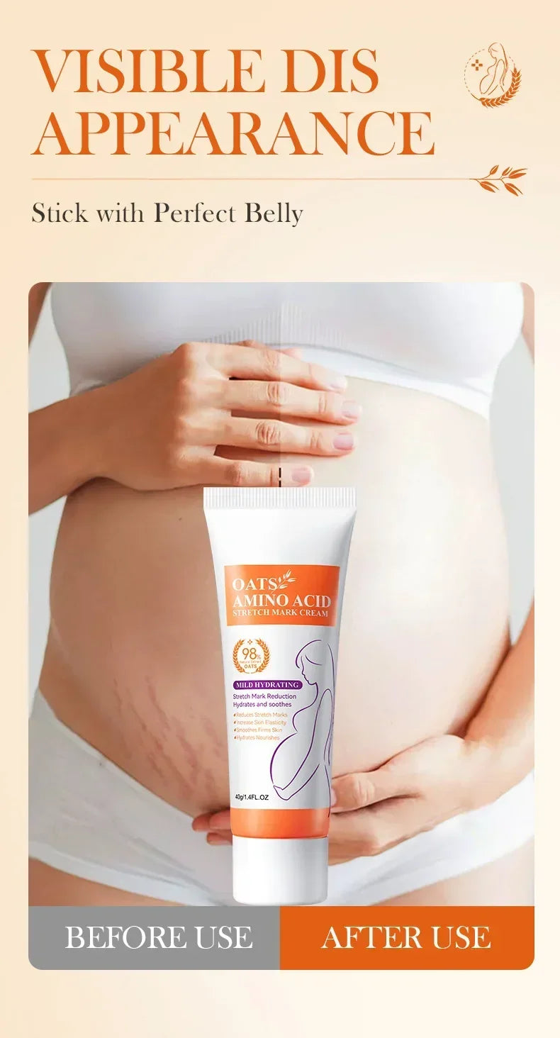 Stretch Marks Permanent Removal Cream — Repair, Firming & Skin Elasticity Body Cream 40g