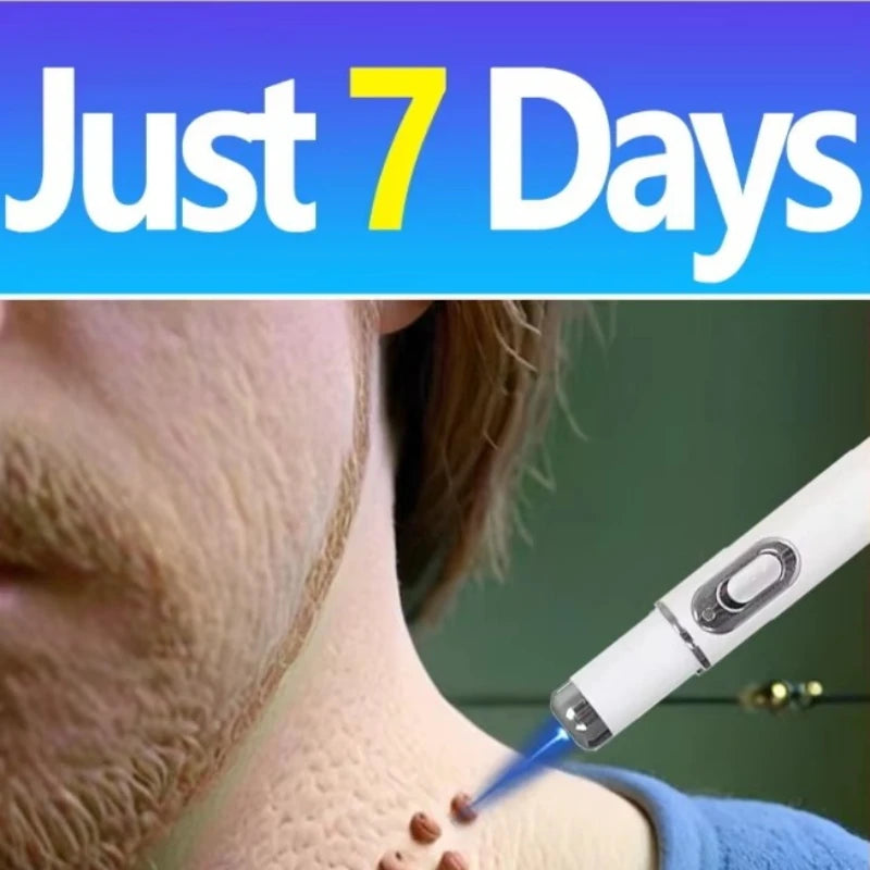 Blue Light Wart & Skin Care Tool — Easy-to-Use Portable Skin Treatment Device