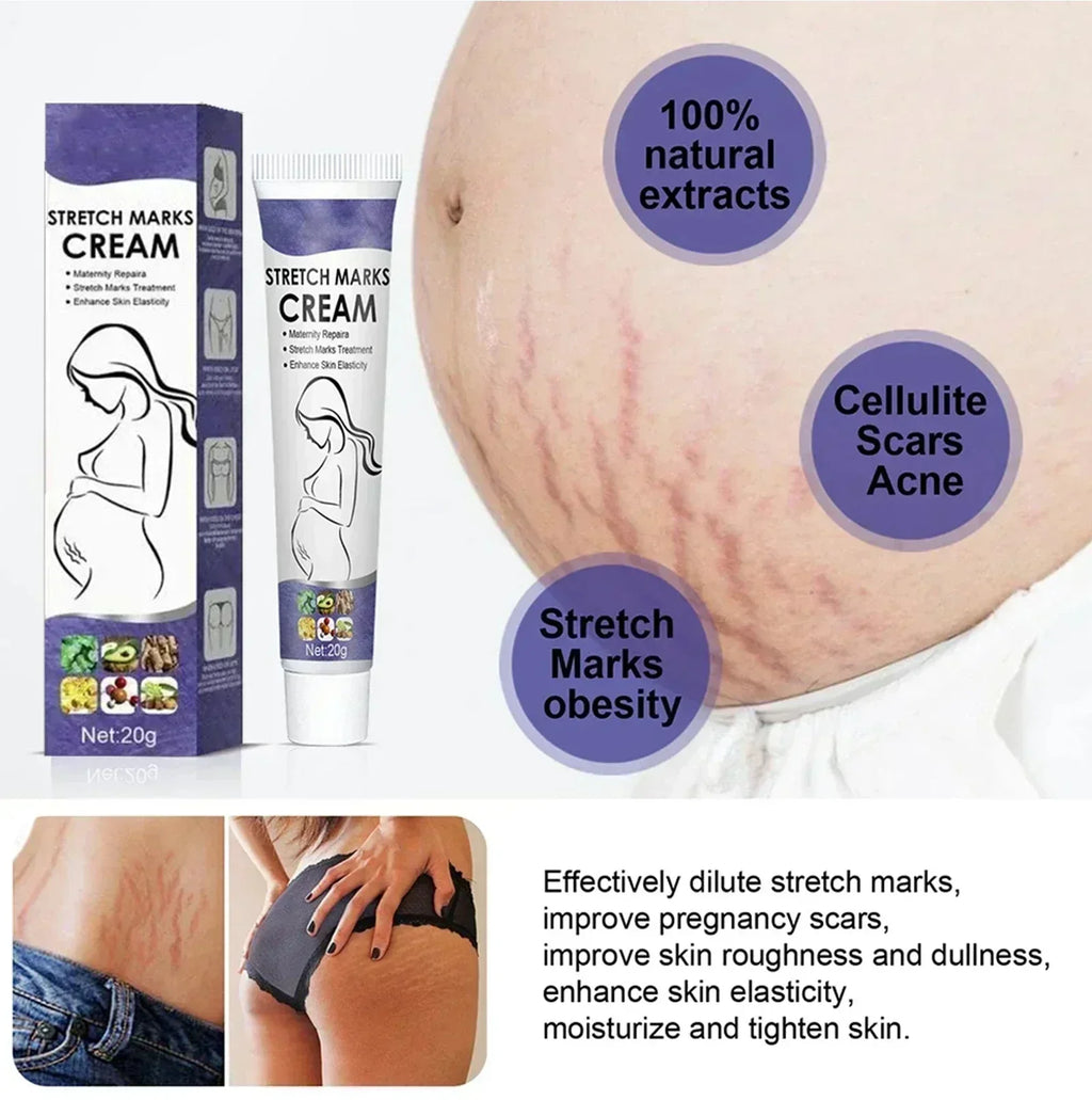 Stretch Mark Vanishing Cream — Buttock, Breast & Body Mark Repair, Firming Maternity Skin Care