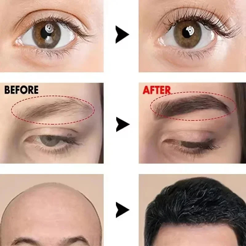 Fast Eyebrow & Eyelash Growth Serum — Anti-Hair Loss