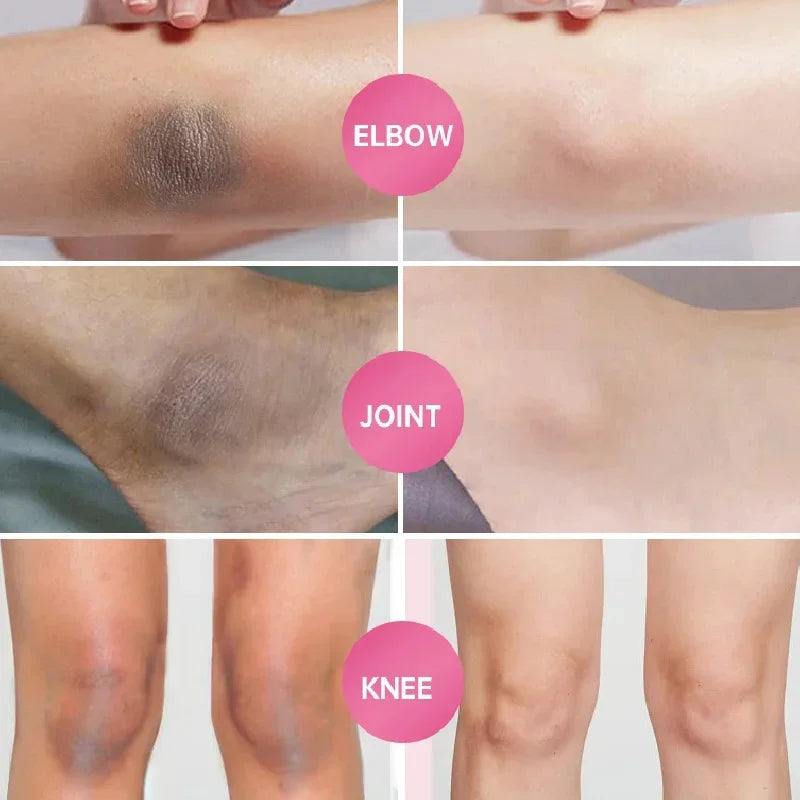 Body Whitening & Brightening Soap Bar – Bleaching Scrub for Knees, Armpits & Intimate Areas