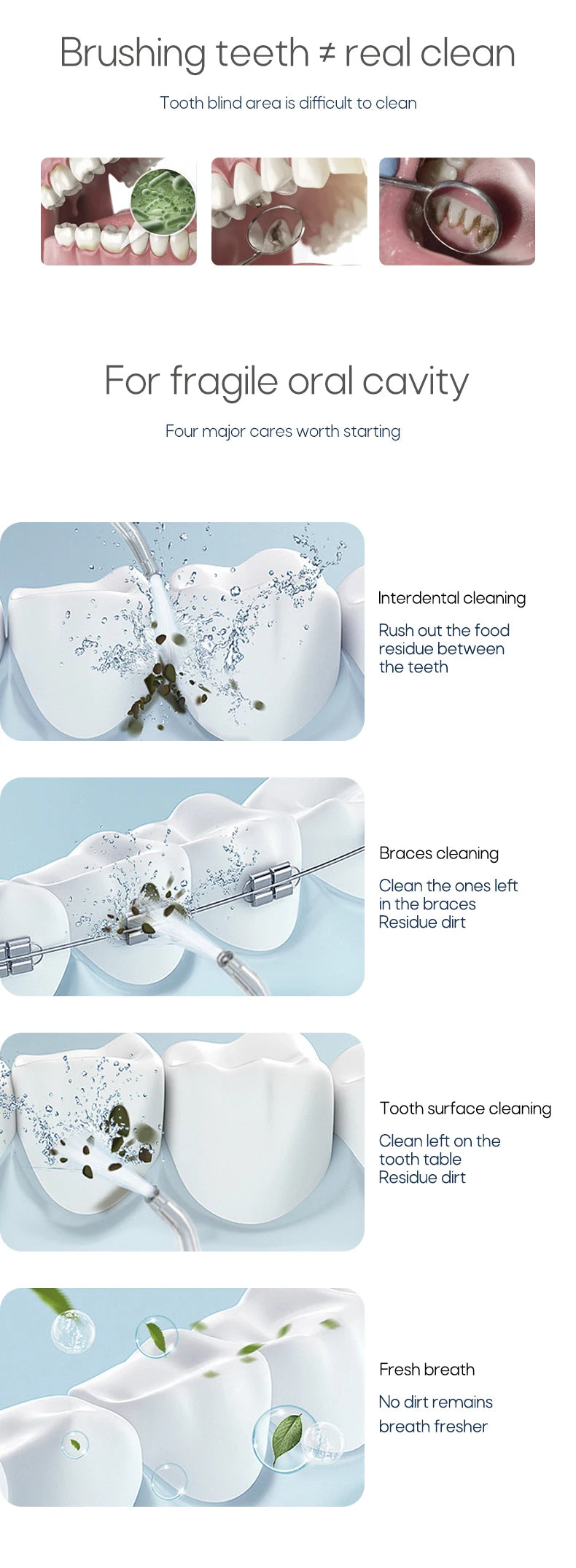 Portable Oral Irrigator – USB Rechargeable, 310ml Tank, 4 Pressure Modes, IPX7, 4 Nozzles