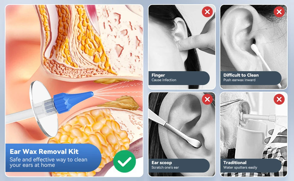 Ear Wax Removal Kit – Manual Ear Irrigation & Flushing System with Basin, 10 Tips & 5-Hole Nozzle