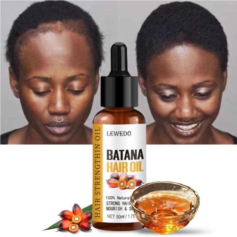 Batana Oil for Fast Hair Growth — Men & Women