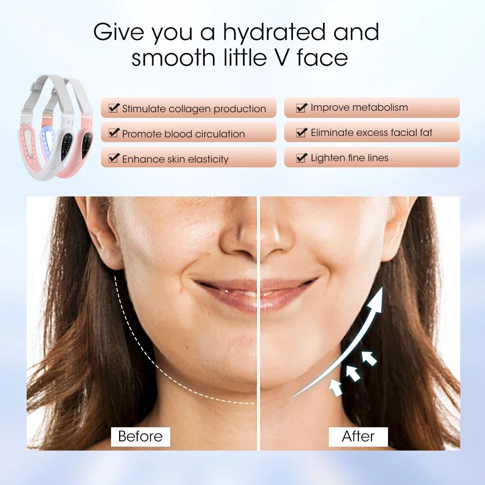 Hailicare V-Face Lifting Massager – Rechargeable Facial Slimming Device with Remote Control