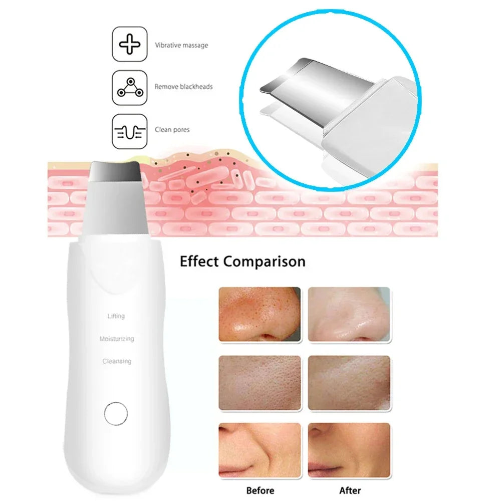 Ion Facial Skin Scrubber – Deep Pore Cleaning, Blackhead Removal & Peeling Device IPX-7 Waterproof