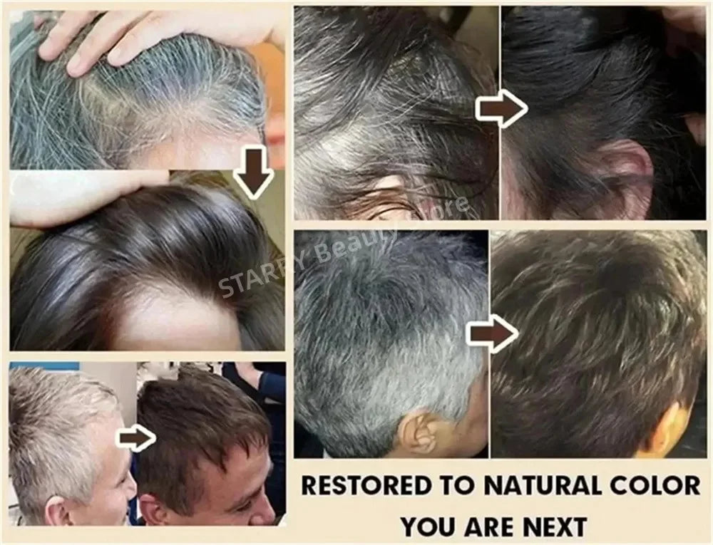 Herbal Anti-grey Hair Treatment Serum Cream White To Black Permanent Repair Natural Color Nourish Scalp Hair Care Products