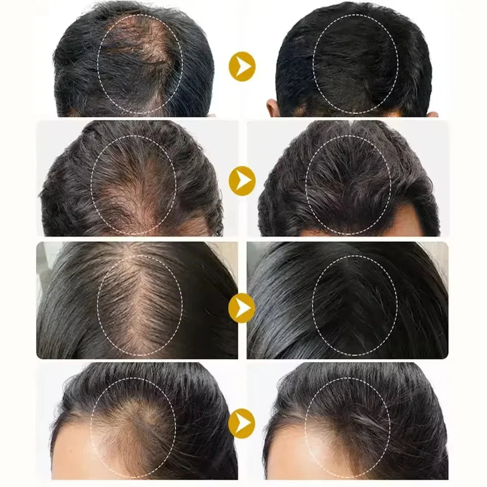 Batana Oil Hair Growth Serum Spray Repair Hair Nourish Root Regrowth Hair Anti Hair Loss Essence Men Women Hair Care Products