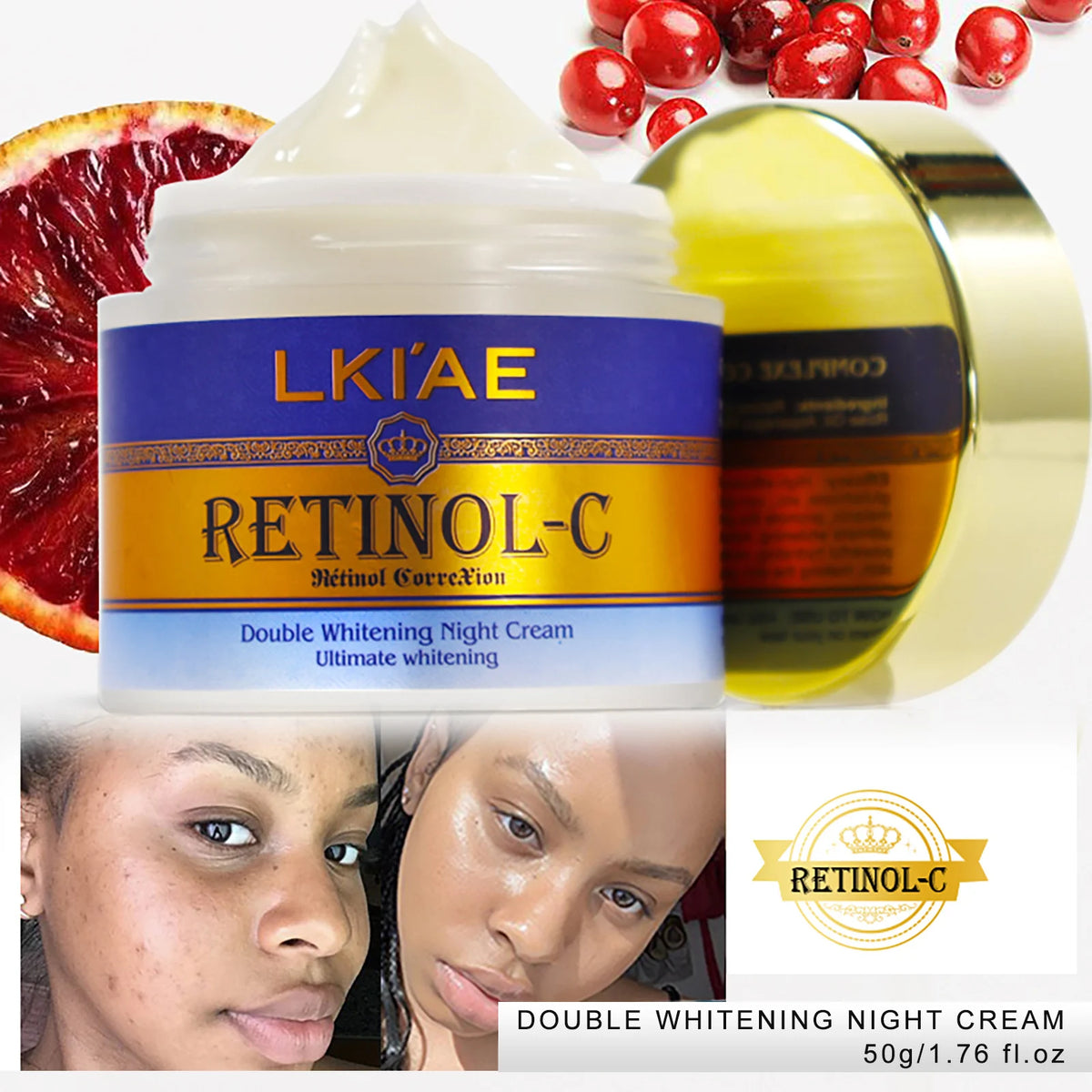 AILKE Retinol Double Whitening 5-in-1 Skincare Kit – Body Lotion, Face Cream, Serum & Cleanser for All Skin Types