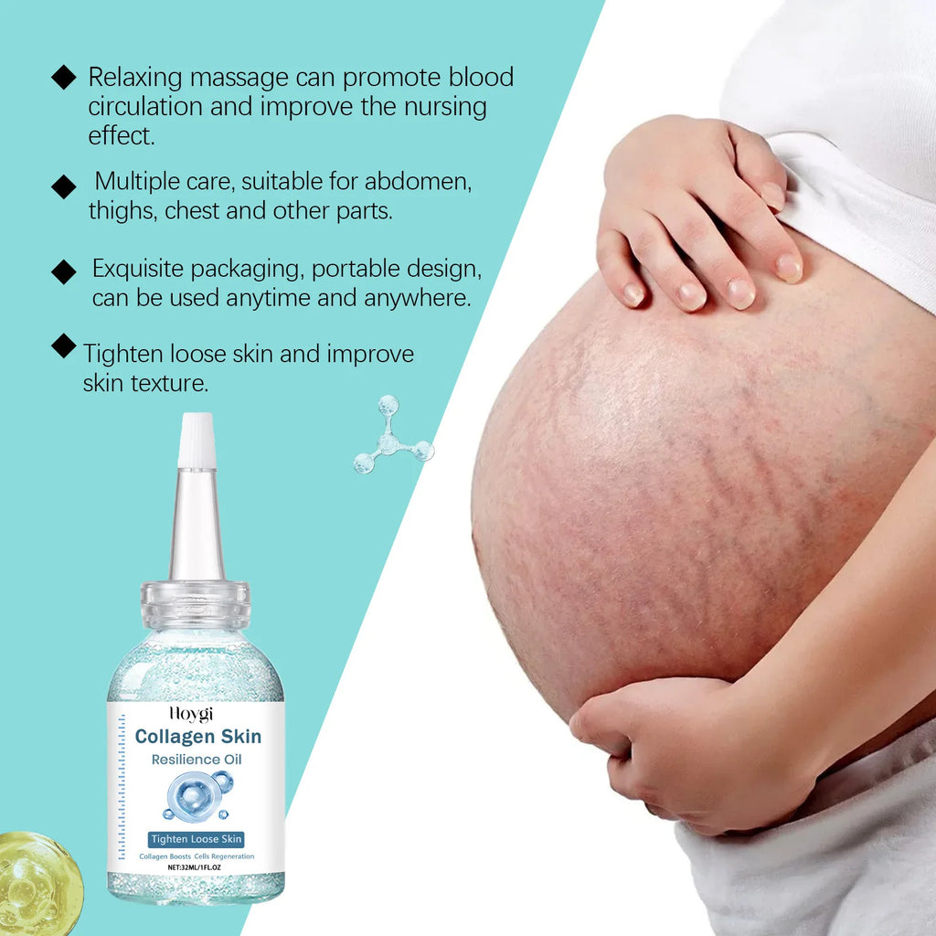 Hoygi Stretch Mark Removal Oil — Anti-Wrinkle, Lifting & Tightening Maternity Scar Repair Oil 32ml