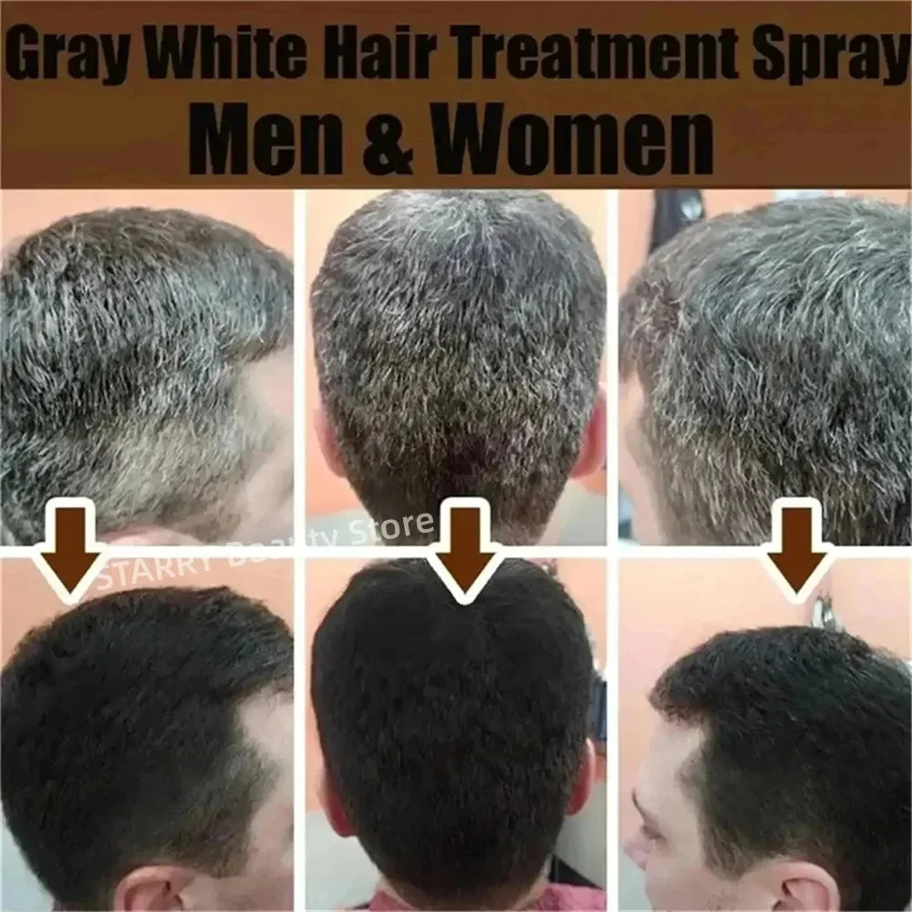 Herbal Anti-grey Hair Treatment Serum Cream White To Black Permanent Repair Natural Color Nourish Scalp Hair Care Products