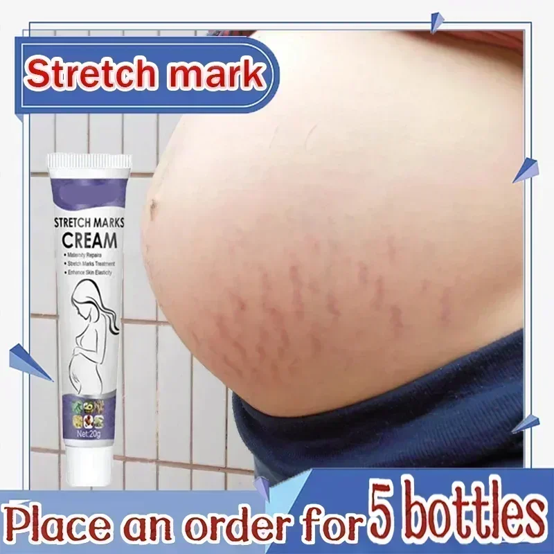 Stretch Marks Treatment & Repair Body Oil — Anti-Wrinkle Skin Care Oil for Maternity & Postpartum