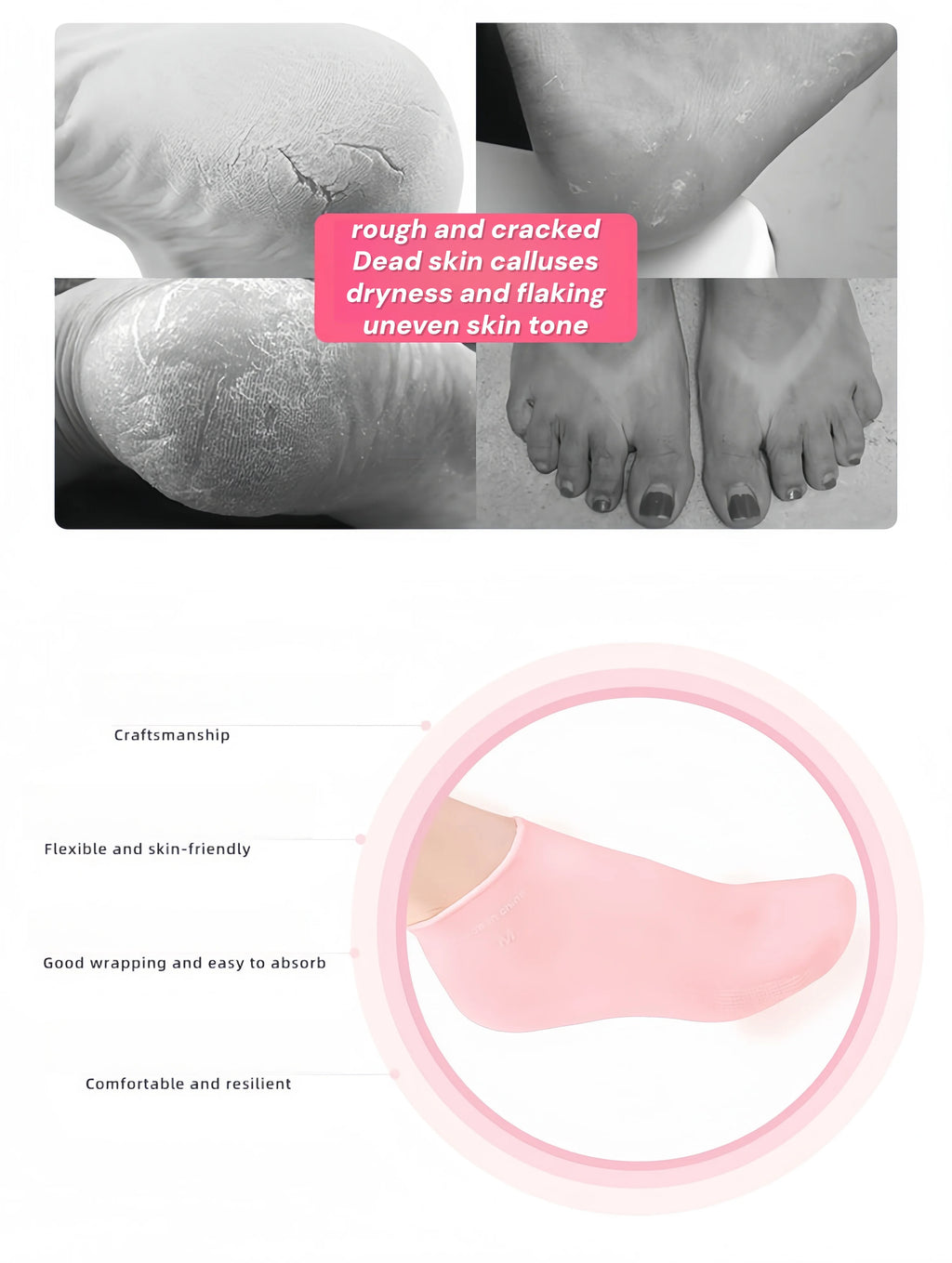 Soft Feet While You Sleep — Moisturizing Silicone Foot Socks | Dry & Cracked Heel Repair, Massage Texture, 7 Colors