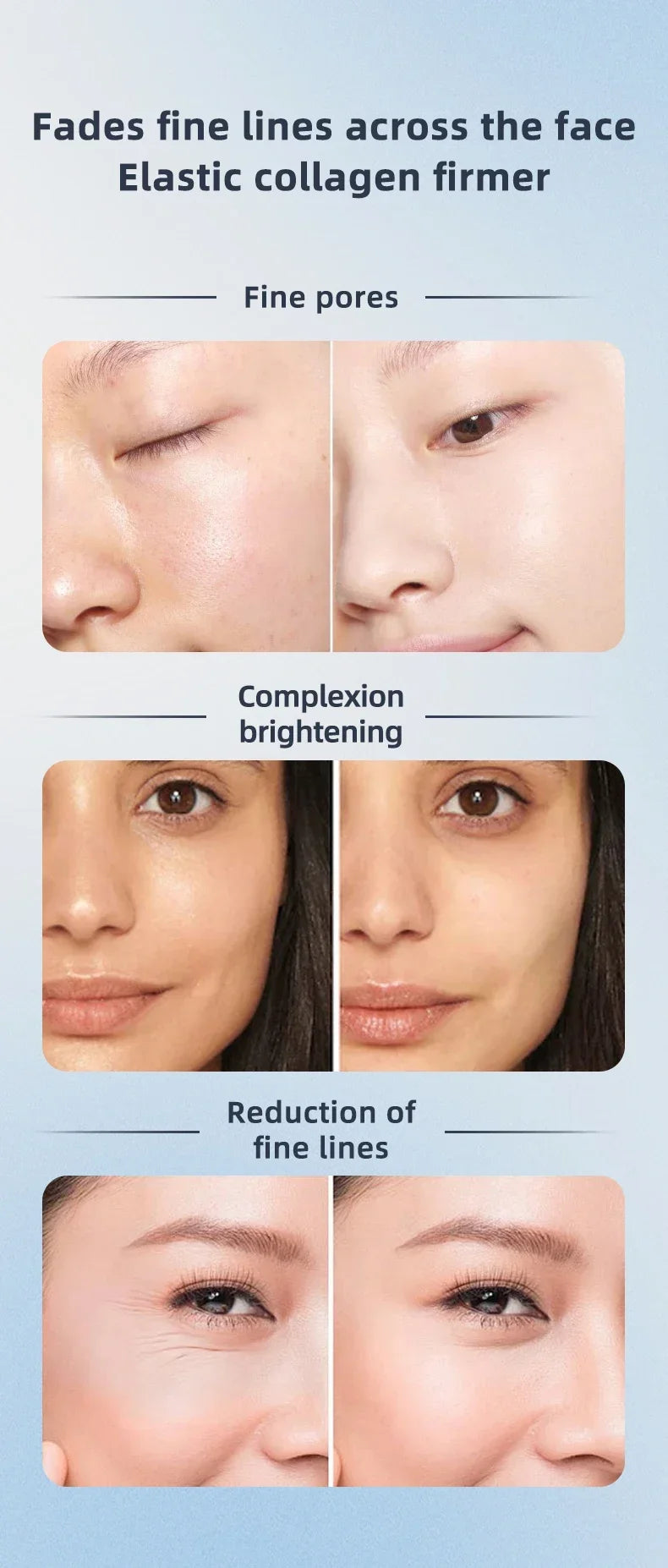 360° Rotating EMS Facial Massager with LED Phototherapy & Heat – Face Lift, Skin Tightening & Anti-Wrinkle Beauty Device